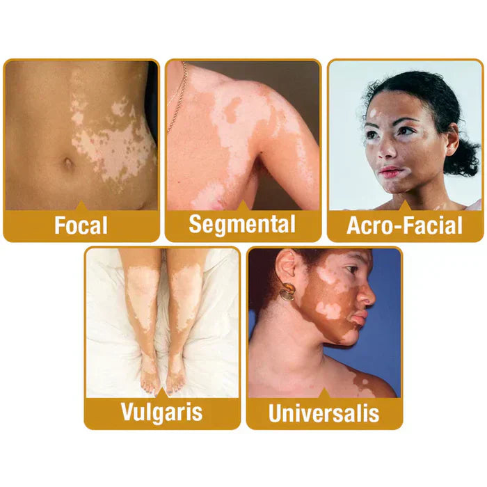 Revitalizing Bee Venom Cream – Natural Skin Restoration & Vitality
